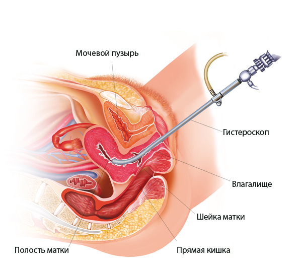 Лечение бесплодия в Челябинске
